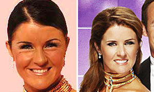 Strictly Come Dancing's Erin Boag's facial transformation